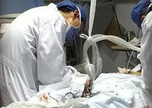 奇闻 ！河南男子生殖器突然起火，女友下体惨被烧伤