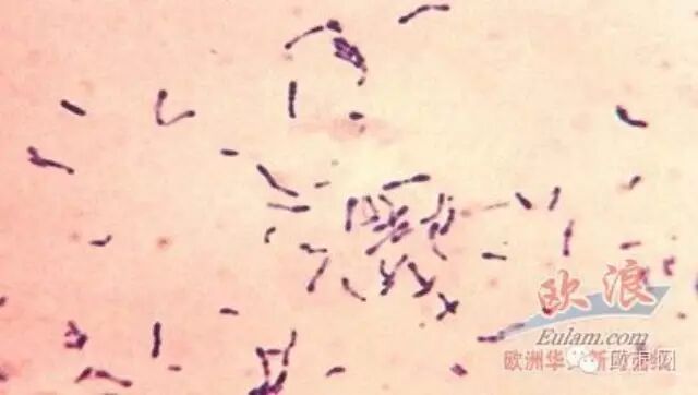 加泰罗尼亚白喉扩散 已有30多人感染