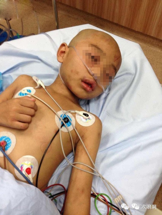 【求助】温州灵溪7岁男童生命垂危，年迈祖母含泪求救