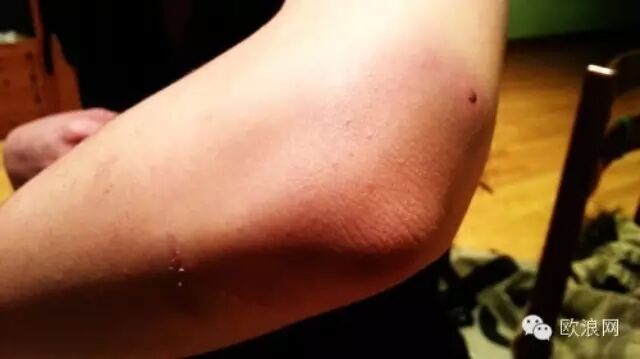 巴塞华人因住宿起纠纷一保姆涉嫌私闯民宅 且协同他人对一单亲母亲施以暴力