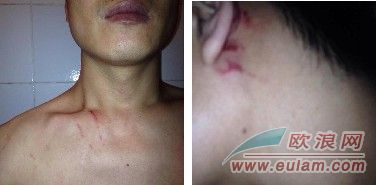 马德里一男侨胞声称遭妻子严重家暴