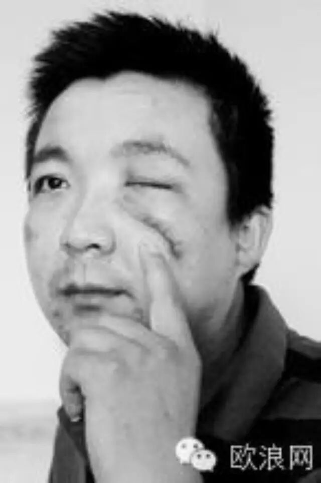 一华商被西班牙窃贼打成左眼失明 三年后终获赔偿
