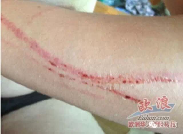 只为买烟的五欧分 巴塞一华人酒吧夫妇遭酒鬼行凶