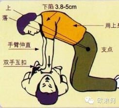 【经典】史上最全的急救方法，收藏可以救人！