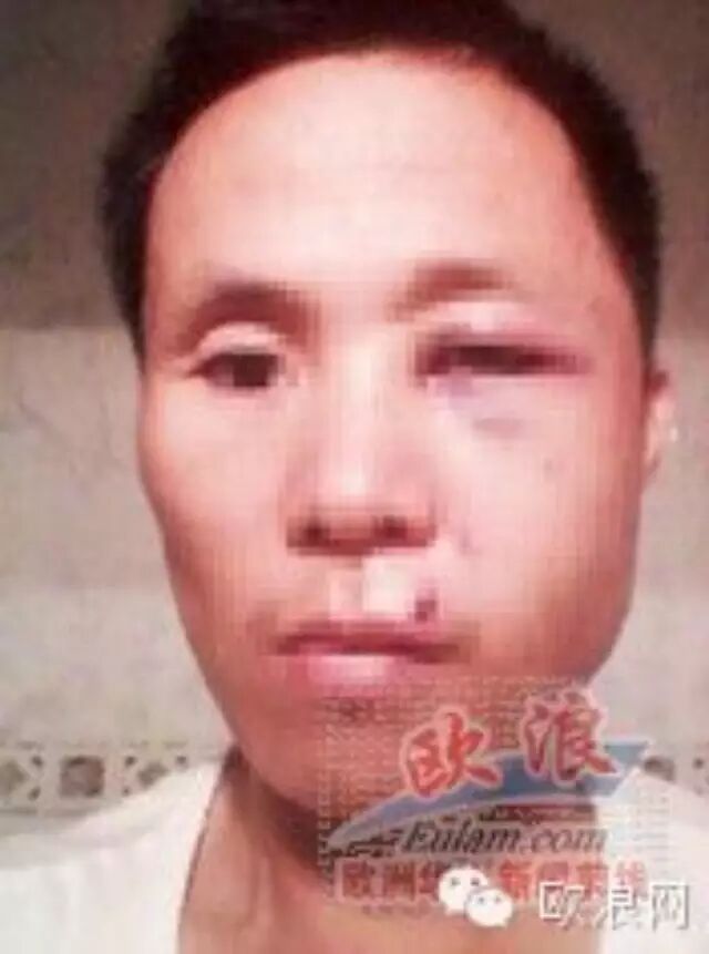 马德里华人父女遭吉普赛人野蛮殴打 反遭对方诬告伤人