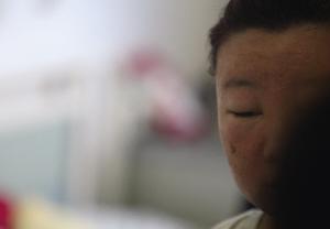 意大利华人男子朝妻子脸上泼胶点燃致其毁容
