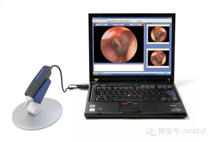 听力筛查仪怎么看丹麦尔听美otometrics-听力筛查诊断中心全面解决方案_https://www.jmylbn.com_新闻资讯_第25张