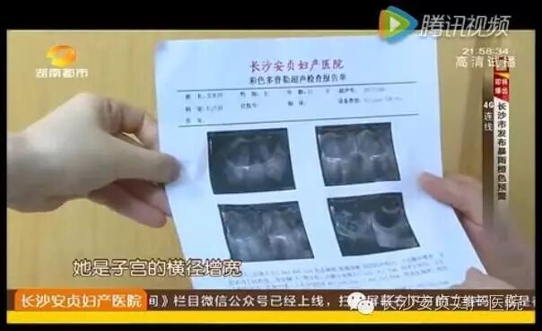 罕见双子宫致流产,还能怀孕吗?-怀孕期