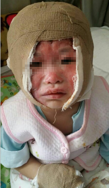 365爱在祥云--关爱烧伤儿童迎六一公益活动 5月24日不见不散 