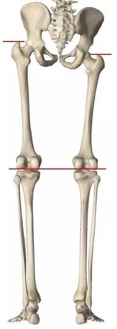 结构性下肢不等长 结构性下肢不等长:下肢骨骼(股骨或胫骨)长度不一致