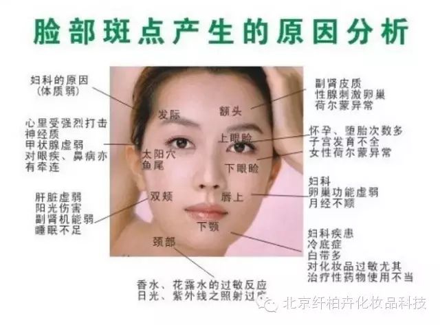 斑的产生原因与分析?太全面了