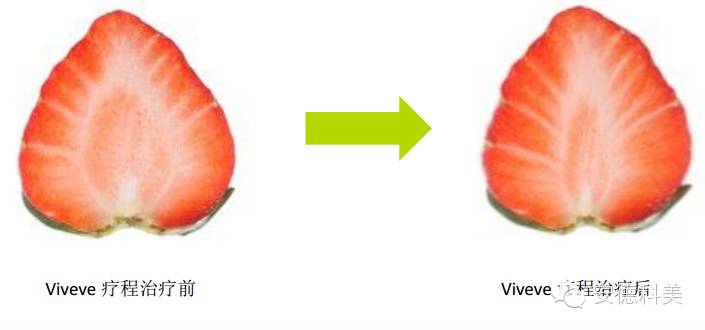 二胎政策放开,女人,你们怕了吗?-怀孕期