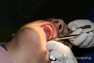 【口腔患者谨记】牙医说给口腔患者的真心话!