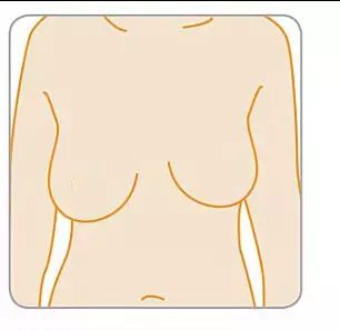 1 乳房的大小和形状发生改变