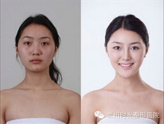 时光微整形,改变只需一点点!