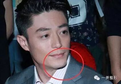 霍建华你的下巴怎么了,胡歌他知道吗?
