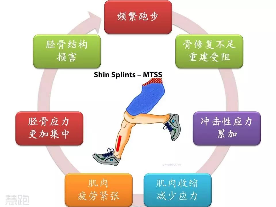 为什么跑步小腿会痛 <wbr>——胫骨内侧应力综合征完全康复方案-1