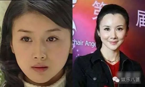 孙菲菲如何从第一古典美女作成了整容狂