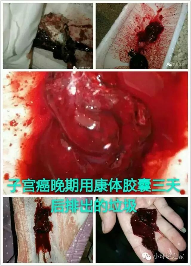 错误观念让你与机会失之交臂~【癌症可以不死!心脏支架可以不搭.