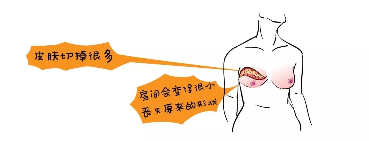 乳腺癌患者也要挺挺的做女人