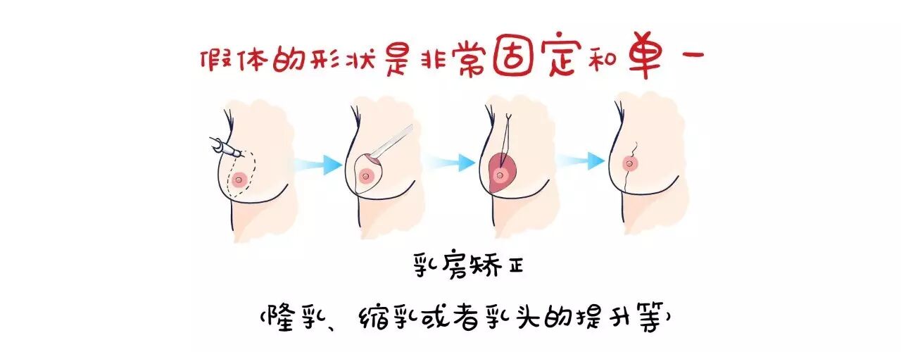 乳腺癌患者也要挺挺的做女人