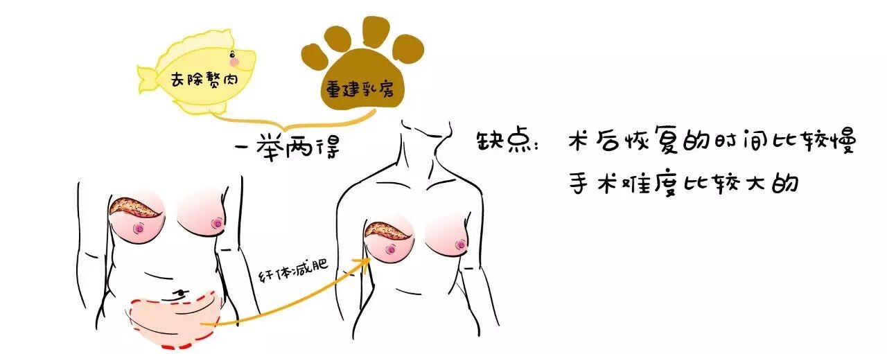 乳腺癌患者也要挺挺的做女人