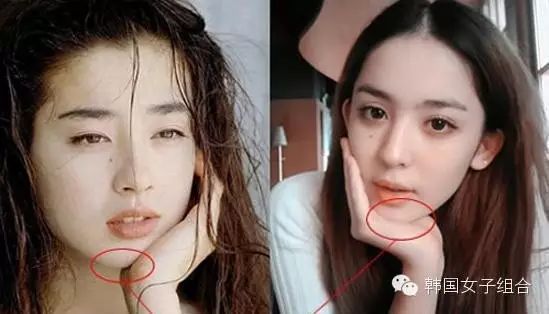 张翰女友古力娜扎整容