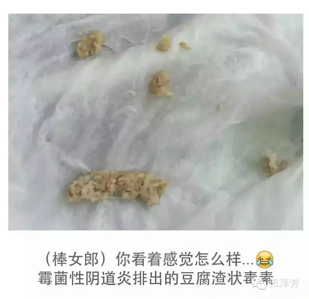 女性妇科疾病案例分析,棒女郎帮你解决你的妇科难题