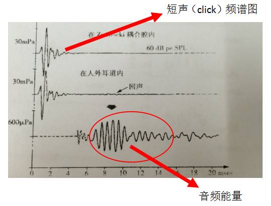 耳声发射图怎么看几种耳声发射的临床类型及特点_https://www.jmylbn.com_新闻资讯_第4张