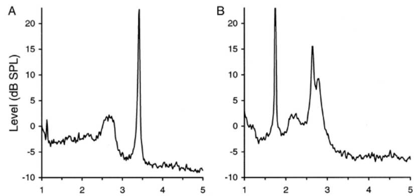 耳声发射图怎么看几种耳声发射的临床类型及特点_https://www.jmylbn.com_新闻资讯_第2张