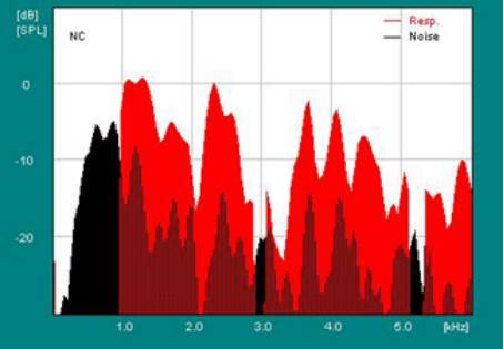 耳声发射图怎么看几种耳声发射的临床类型及特点_https://www.jmylbn.com_新闻资讯_第5张