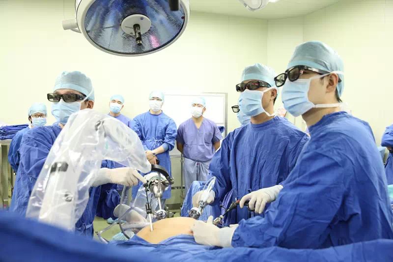 国内首例3d腹腔镜袖状胃切除术手术现场