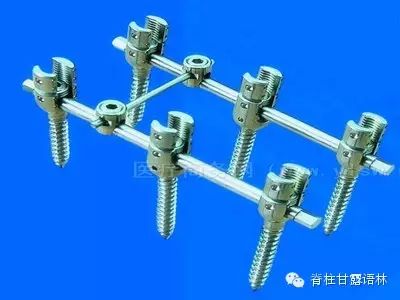 国际学术探讨之四:脊柱椎弓根钉融合的四个问题