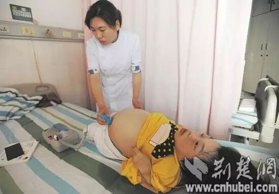 89厘米袖珍“瓷娃娃”怀孕后勇敢决定当妈;兰博基尼出租车 三千多元起跳;发小蒙面入室抢劫被认出 称:就当愚人节吧(每日五佳帖)-怀孕期