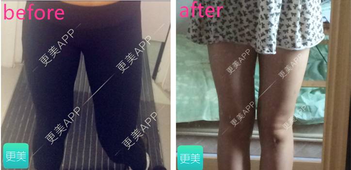 大S惊爆怀二胎 娱乐圈里二胎辣妈是咋保养的?-怀孕期