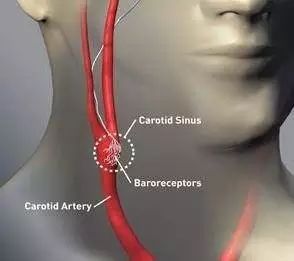 祁炜罡解释,颈动脉窦是人体的一个压力感受器,对外来刺激相当敏感.