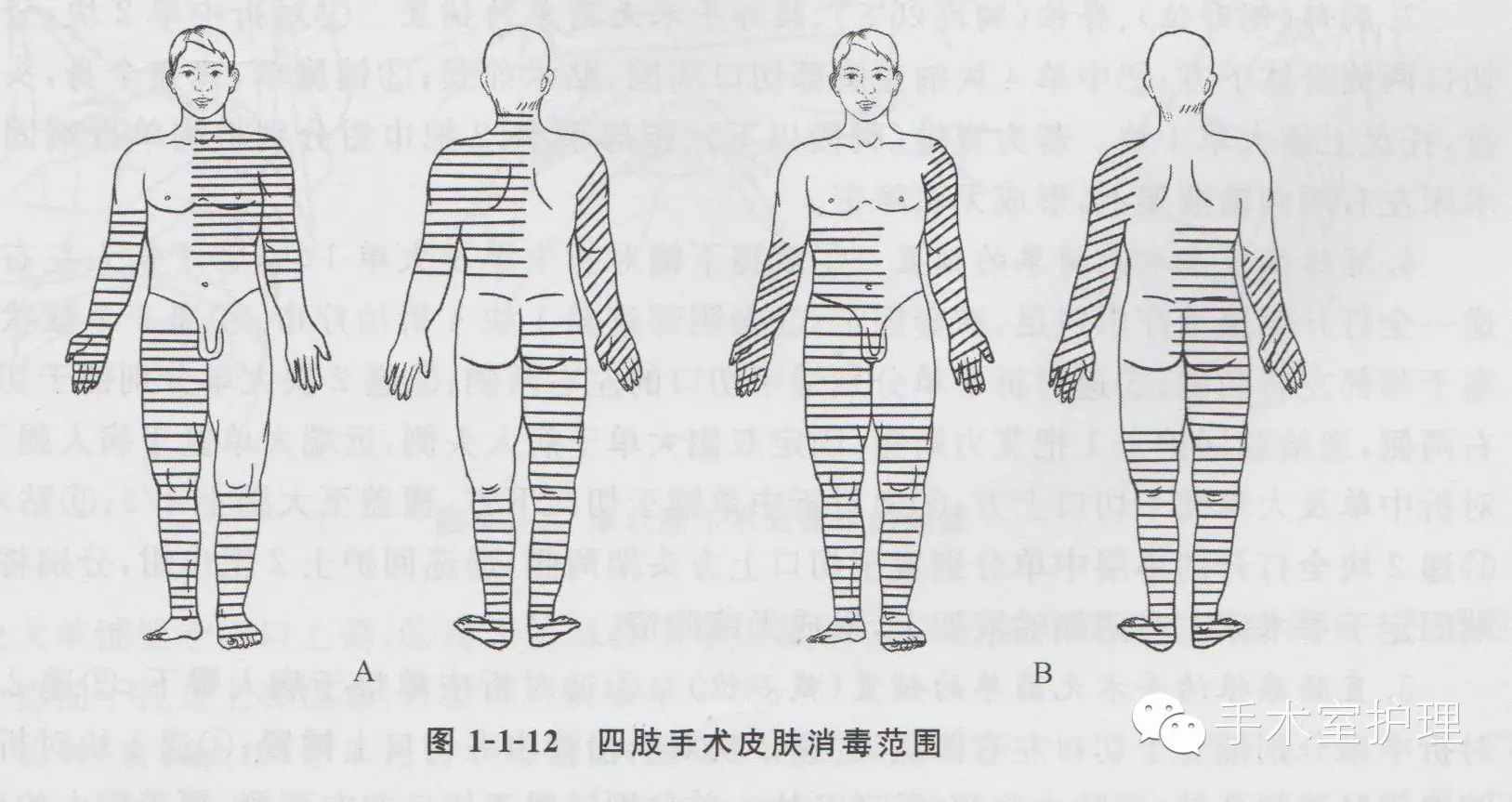 【图】手术野皮肤消毒范围