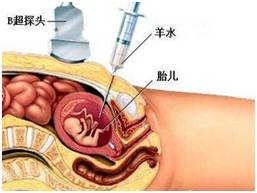 二胎来了-高龄产妇必备攻略 晓健康微讲座(第11期)-怀孕期