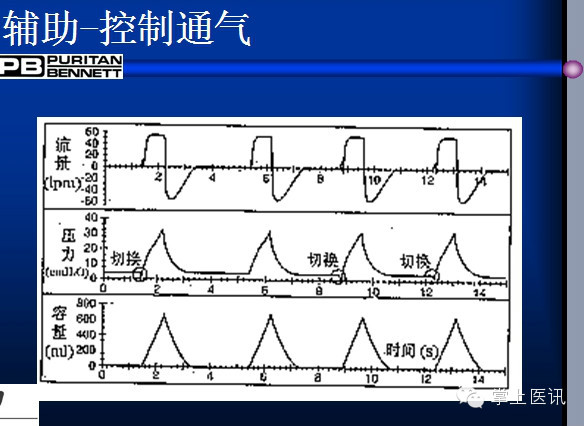 菜鸟学呼吸机每个icu人都应了解