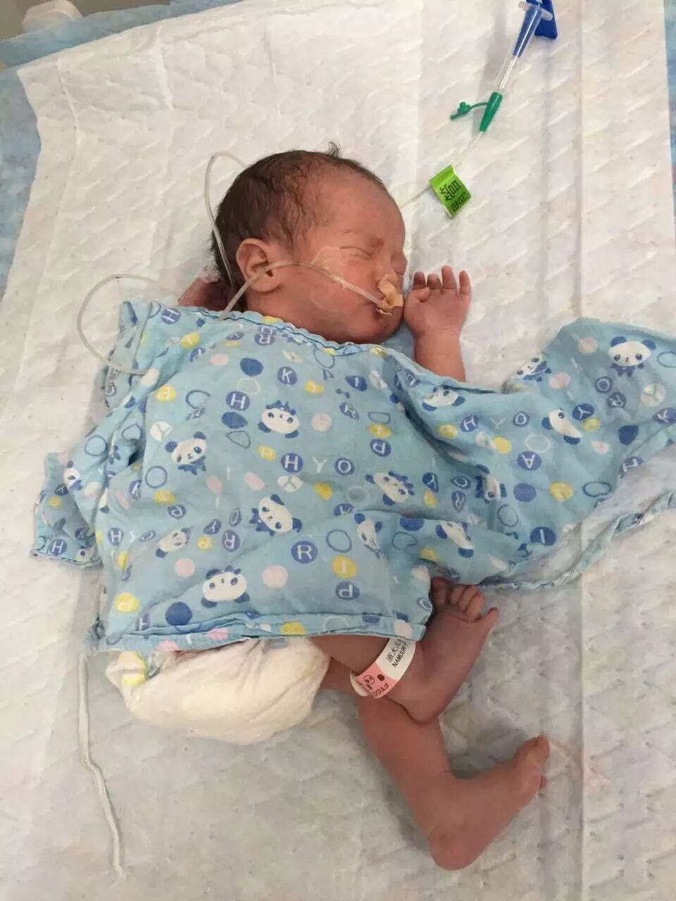 蒙古夫妇专程来杭州求医 只因胎儿患上罕见“怪病” 专家建议:二胎放开后,有疾病的胎儿可先看儿科再决定去留-怀孕期