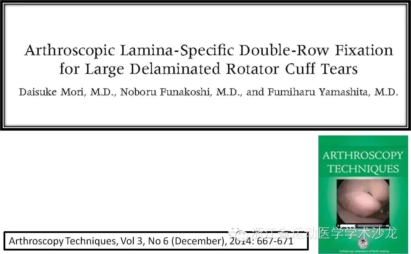 关节镜下特殊的薄层(Lamina-Specific)双排缝合技术治疗...