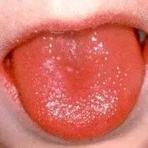 宝宝出疹子你怕不怕？史上最全出疹攻略（推荐收藏）微...