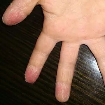 宝宝出疹子你怕不怕？史上最全出疹攻略（推荐收藏）微...