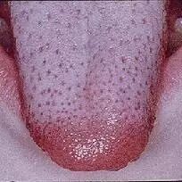 宝宝出疹子你怕不怕？史上最全出疹攻略（推荐收藏）微...