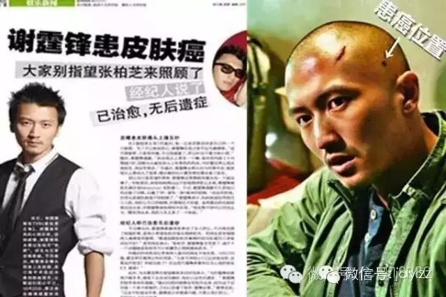 谢霆锋患皮肤癌,惊醒了多少人?