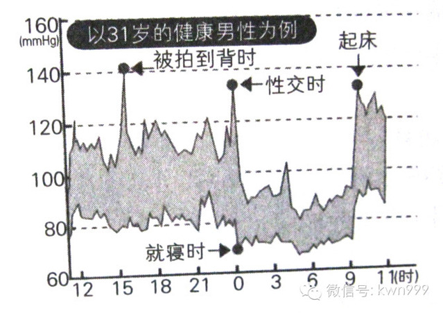 血压一天中规律的变化着