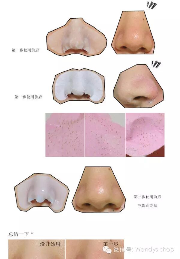 草莓鼻克星 <wbr>【韩国猪鼻贴 <wbr> <wbr>去黑头3步曲】