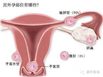 明明怀孕 宝宝在肚中凭空消失? 这件事江西准妈妈要小心-怀孕期