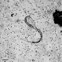 在人类宿主体内,丝虫的成虫会生活在比较固定的皮下组织中,通常见于
