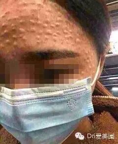 �Ƿ�ע�丱����